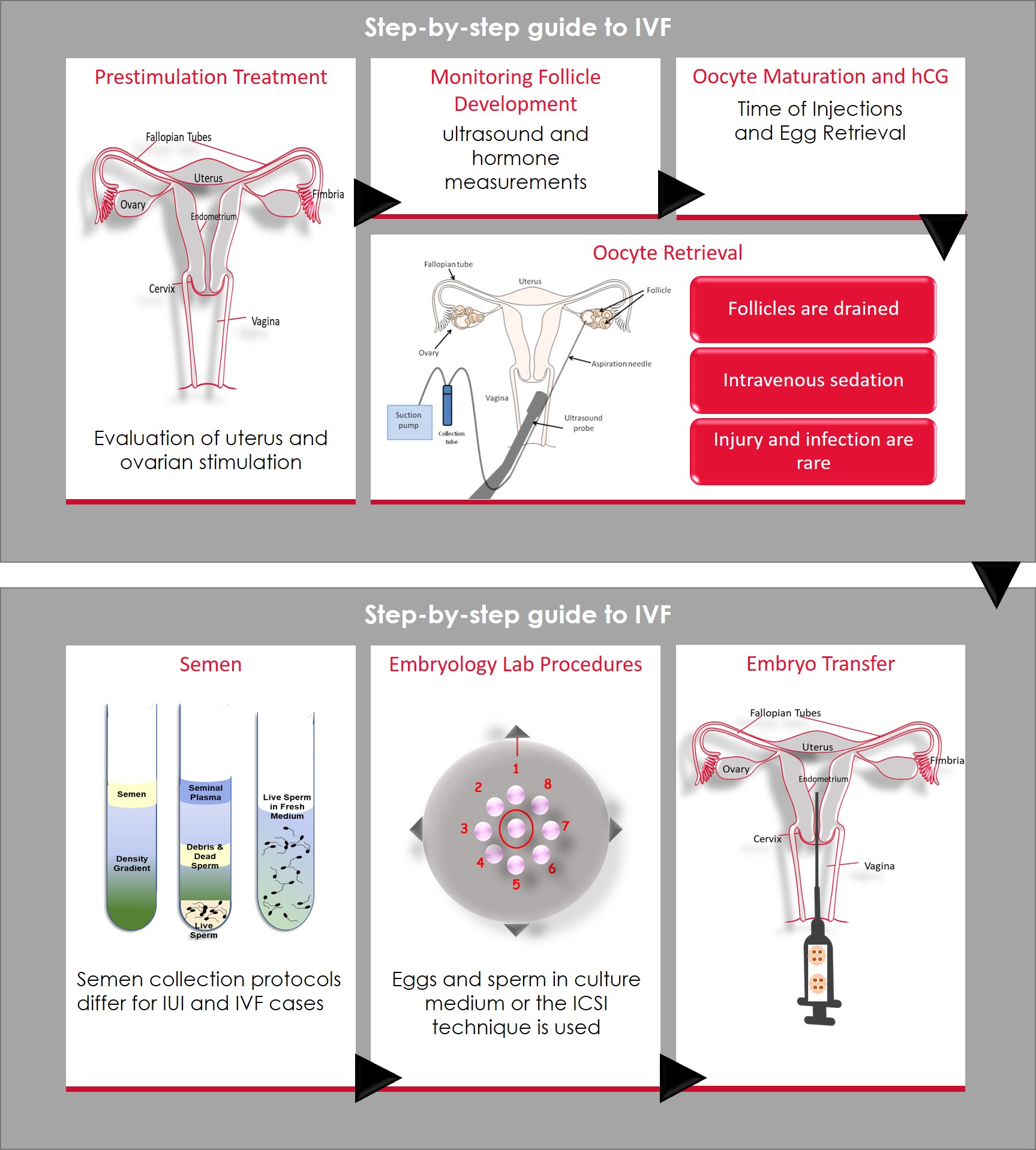 In Vitro Fertilization Infographics 6958