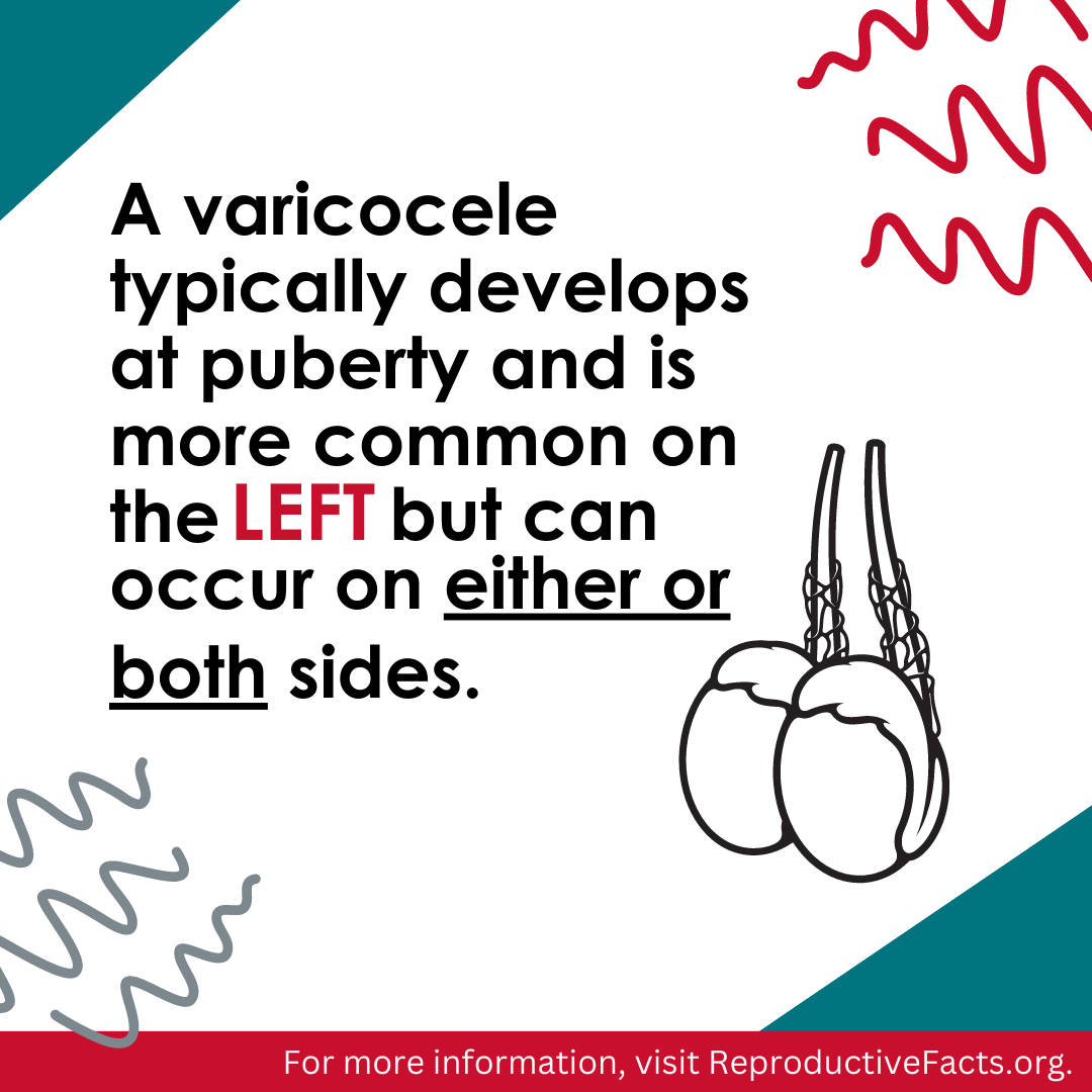 Varicocele patient education fact sheet | ReproductiveFacts.org